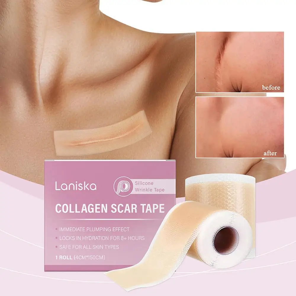 

1 рулон, силиконовый лист для шрамов, 4*150 см, многоразовая самоклеящаяся лента для покрытия шрамов, водонепроницаемые и дышащие листы для шрамов, наклейка для красоты