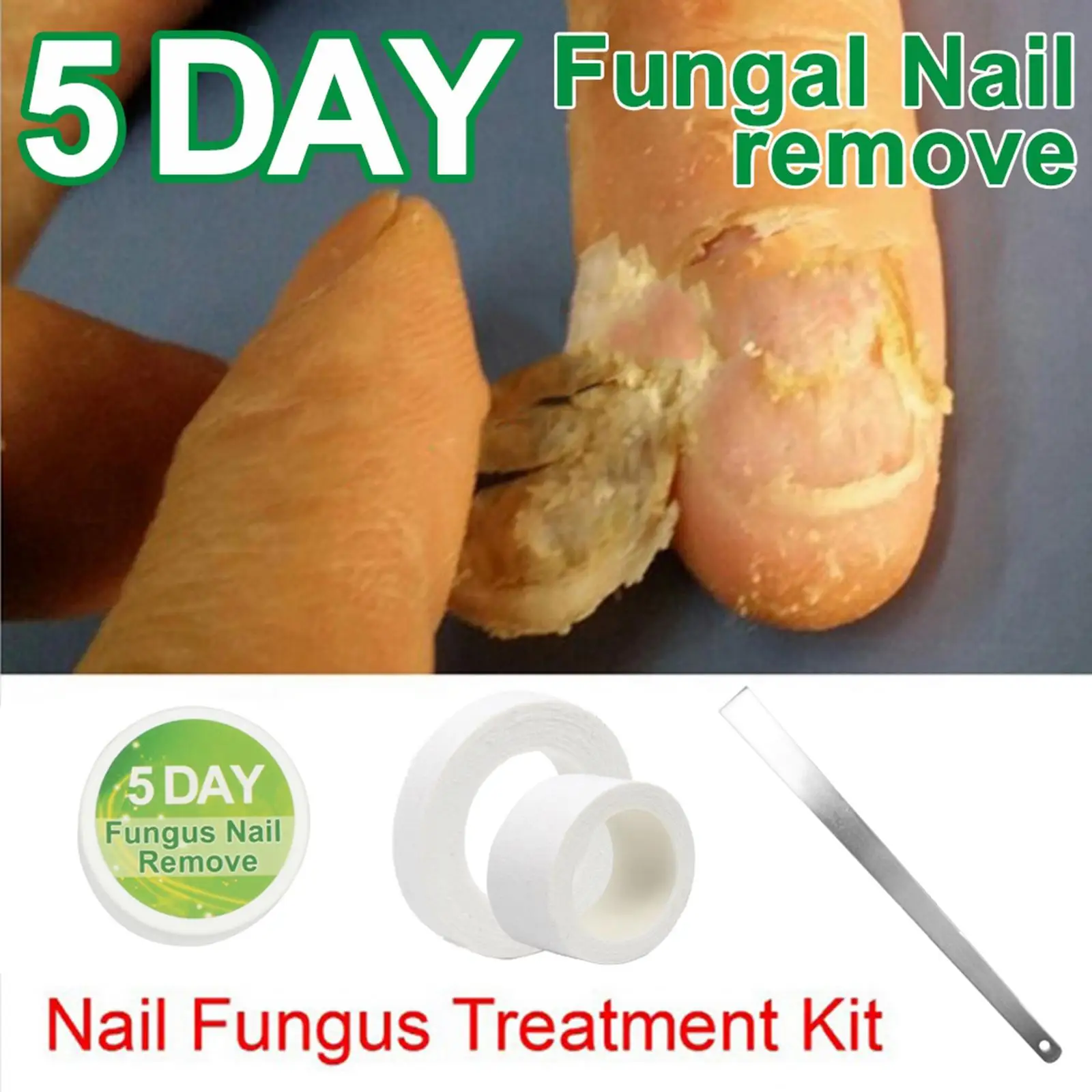 20g Anti Fungus Nail Fungus Treatment Cream Paronychia Anti Fungal Nail Treatments Nail Repair Liquid Foot Care Tools