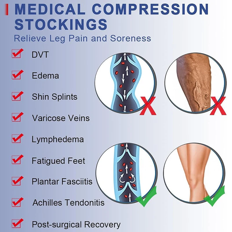 1 para wysokich ud medycznych skarpet antypoślizgowych i oddychających antyżylaków wspomagających krążenie krwi