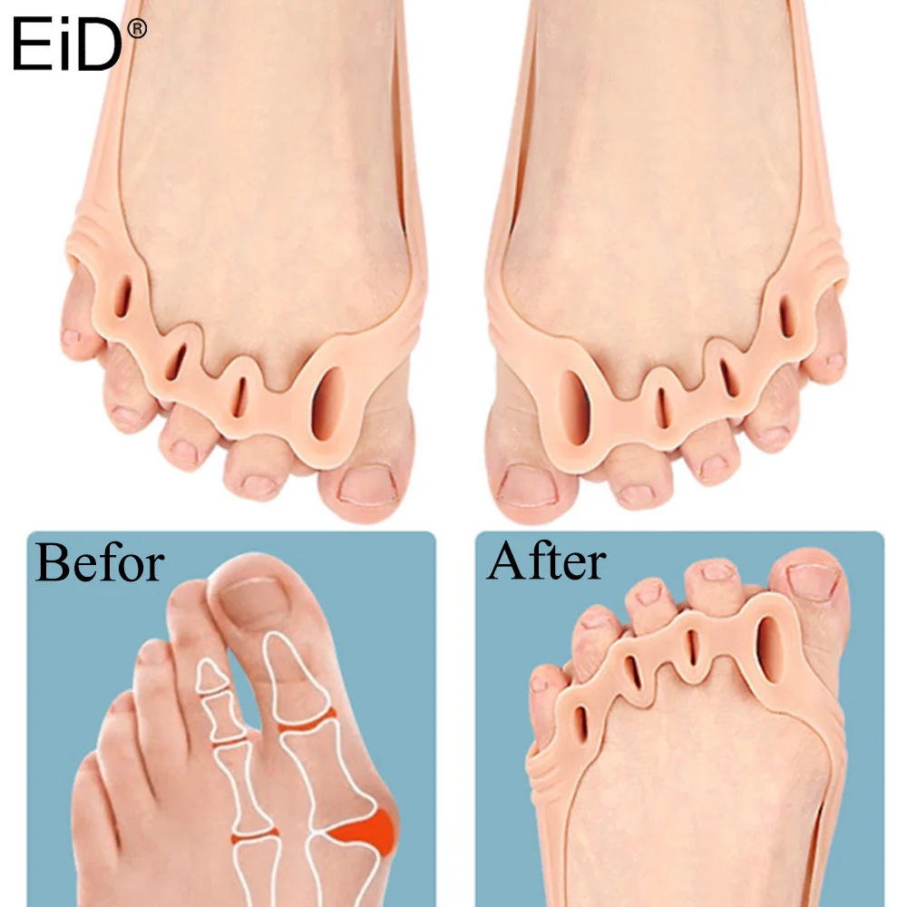 

5 Holes Silicone Toe Separator Metatarsal Pads Pain Relief Forefoot Socks Insole Bunion Orthotics Hallux Valgus Corrector Unisex