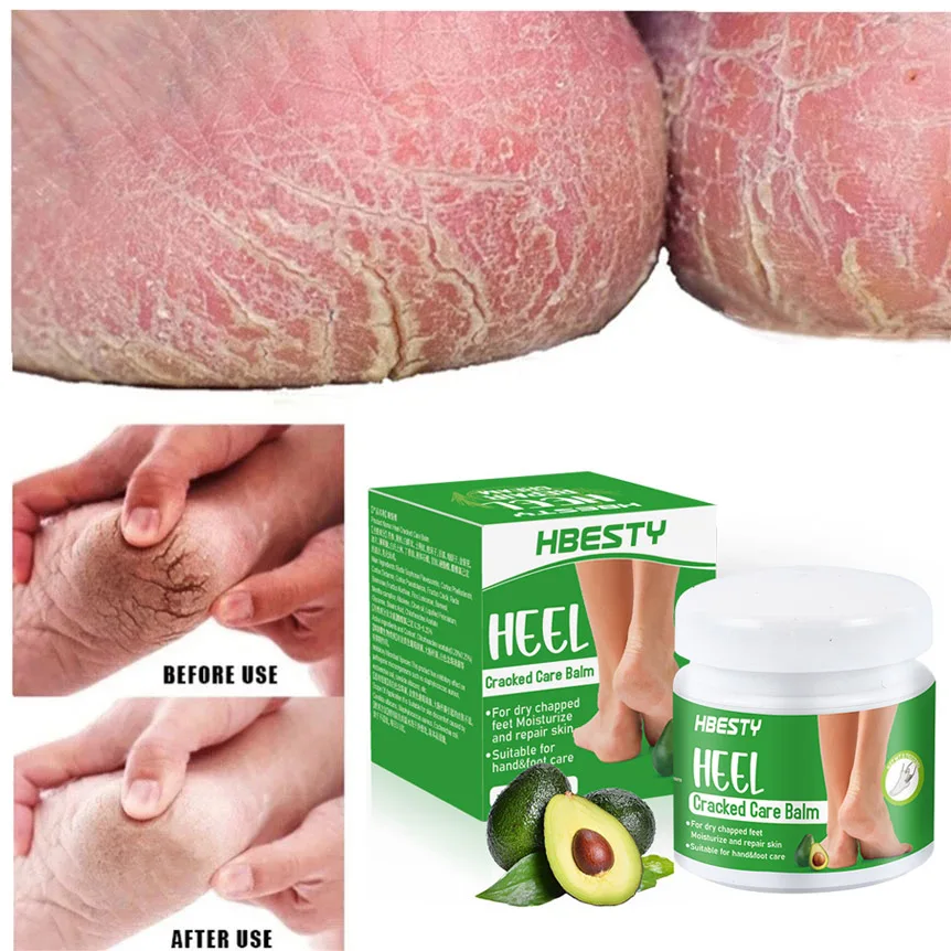 

Anti-Drying Crack Foot Cream Heel Cracked Repair Oil Calluses Removal Dead Skin Smooth Soften Moisturize Hand Feet Care Products