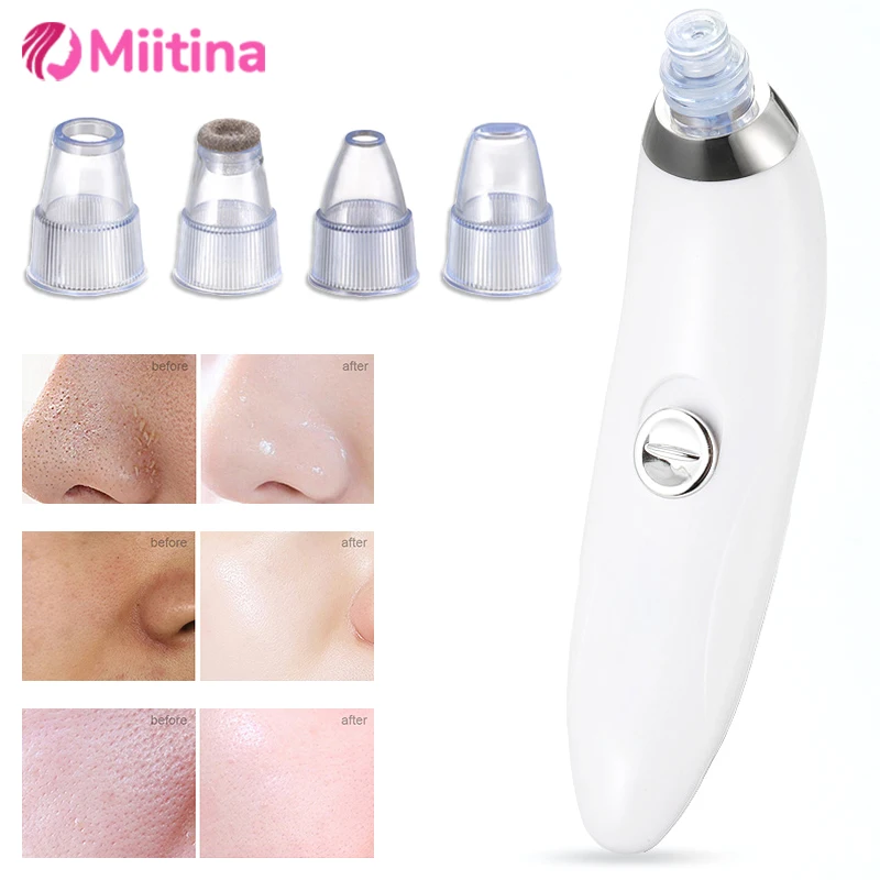 Electric Blackhead Removal Instrument instrument pore cleanser electric suction Face Pore Cleansing Beauty Instrument Skin Care