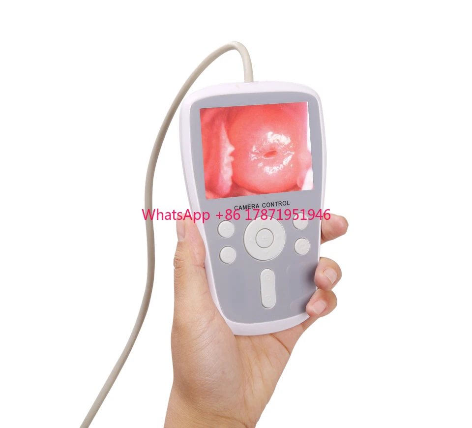 Handheld Digital Video Colposcope PORTABLE VIDEO COLPOSCOPE