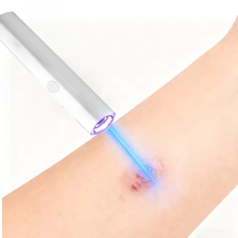 

1st ᵍᵉⁿᵉʳᵃᵗⁱᵒⁿ ᵘᵖᵍʳᵃᵈᵉᵈ wᵃʳᵗ ⸴ ʳᵉpᵃⁱʳ wᵃʳᵗˢ ʳᵒoᵗ ⸴ ᑫᵘⁱᶜᵏˡʸ