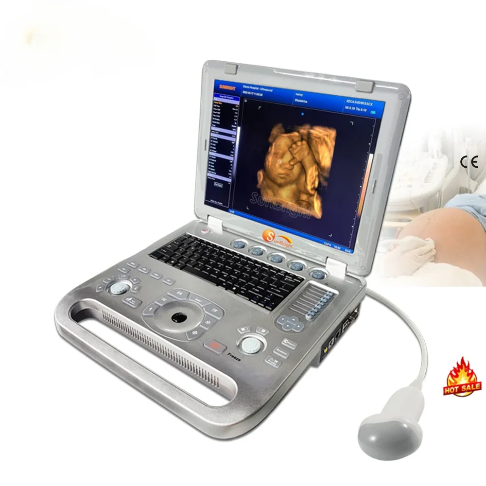 Hot selling promotion laptop 3D OB GYN clear images 4D baby face OB GYN ultrasound machine