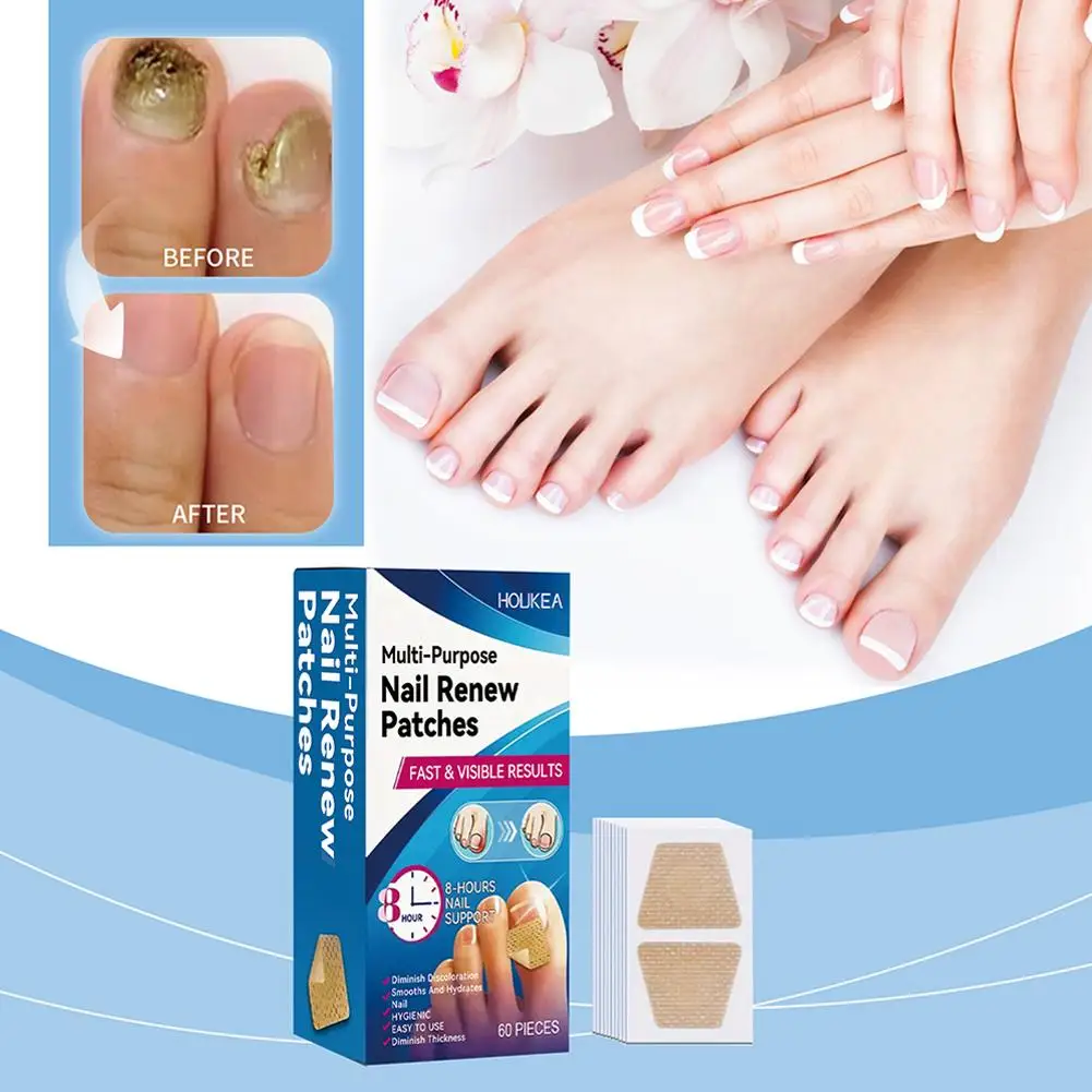 Patch champignon pour ongles des pieds, 60 pièces, patchs de réparation imperméables pour ongles incarnés, autocollants de Correction pour ongles décolorés et endommagés