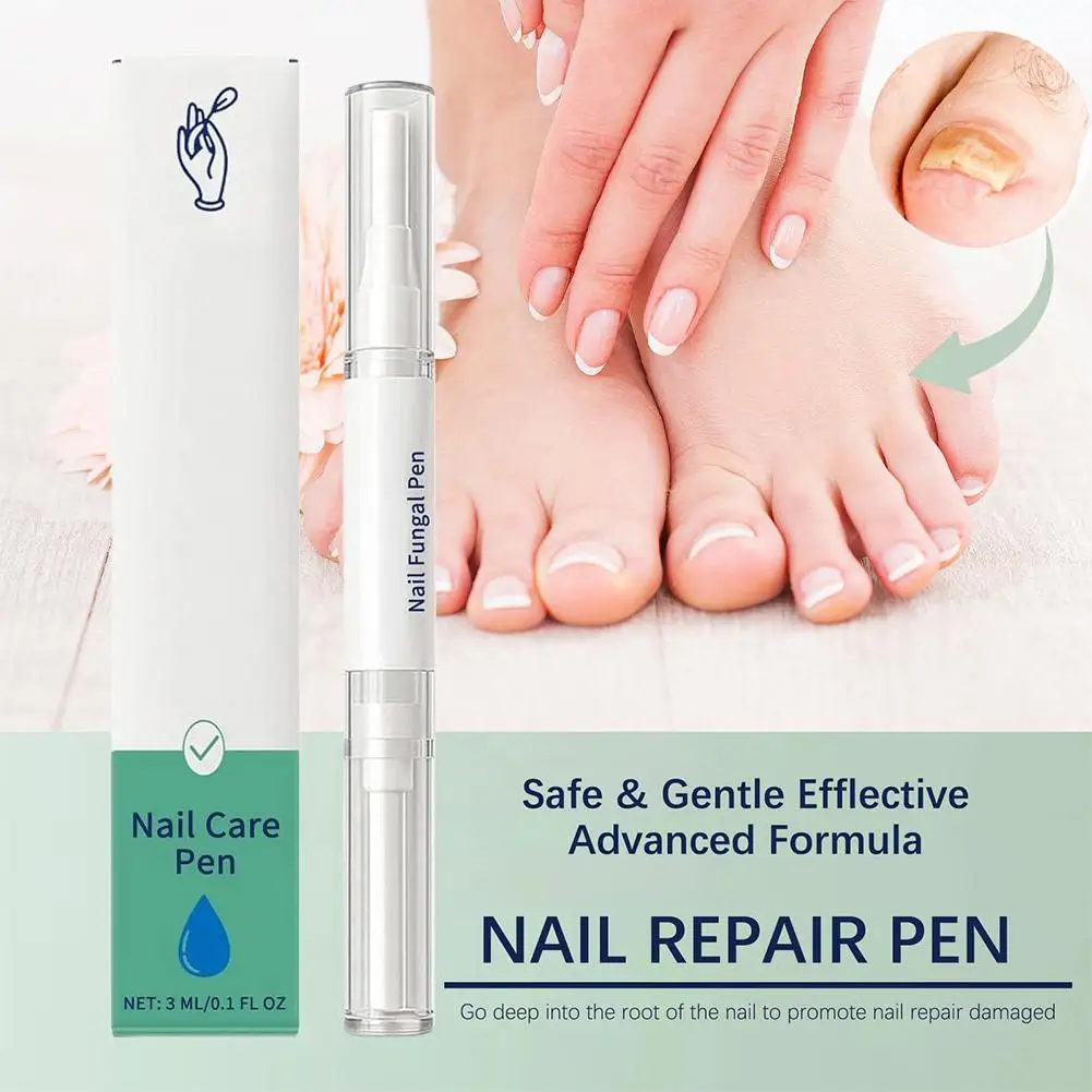 قلم العناية بالأظافر قلم علاج الفطريات ترطيب تعزيز الأظافر التالفة لليد القدم مسمار إصلاح فطريات الأظافر العلاج الرعاية U4O6 #3
