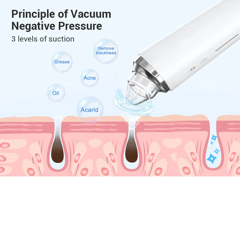 Removedor eléctrico de espinillas, limpiador de acné al vacío, eliminación de cabeza negra, limpieza profunda Facial, máquina limpiadora de poros, herramientas para el cuidado de la piel