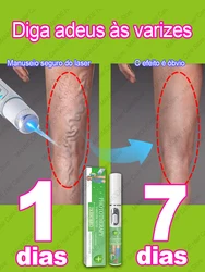 Laser solves various leg problems