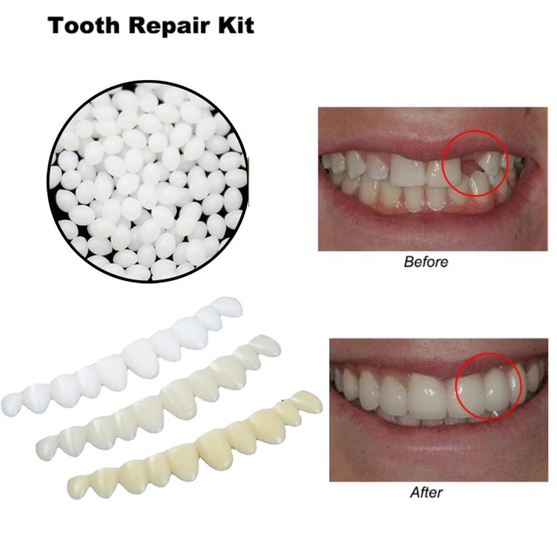 Perfect Fit Teeth Whitening Fake Tooth Cover Snap On Silicone Smile Veneers Teeth Upper Beauty Tool Cosmetic Teeth