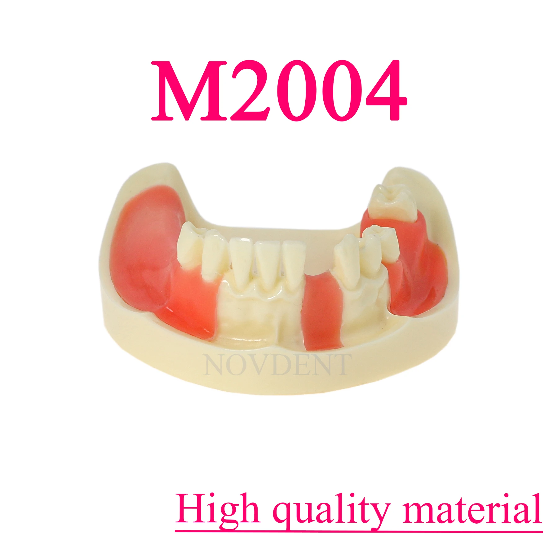 Dental Lower Jaw Implant Restoration Teaching and Research Teeth Model Practice M2004 Typodont