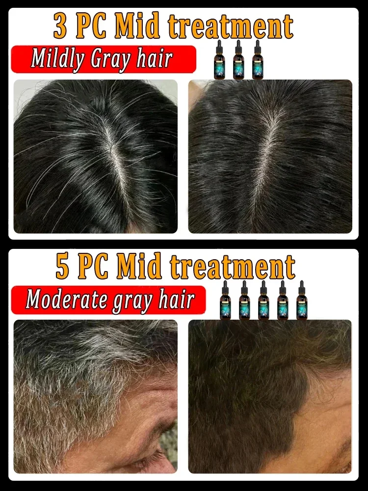 Anti-Grey Hair Essence Serum, Restaurar, Cor Natural, Restaurar, Saudável, Branco para Preto