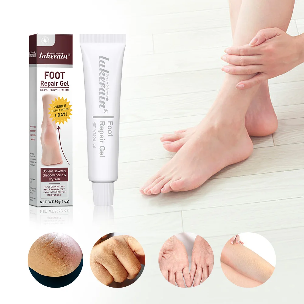 

30g Foot Repair Gel Feet Care Mask Foot Cream for Hand Cracked Repair Cream Removal Dead Skin Hand Feet Care