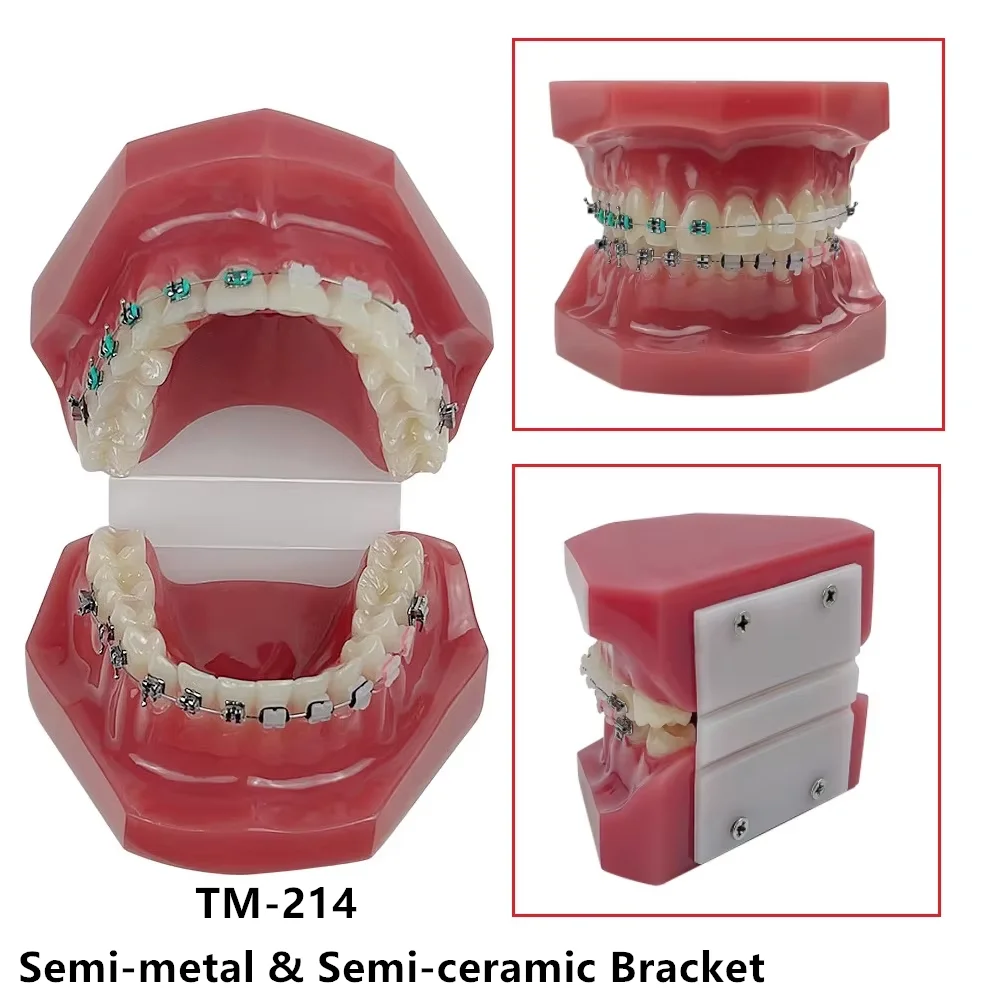Adult Teeth Model Dental Teaching Tooth Orthodontic Model With Brackets Ortho Treatment Typodont For Dentistry Students Dentist