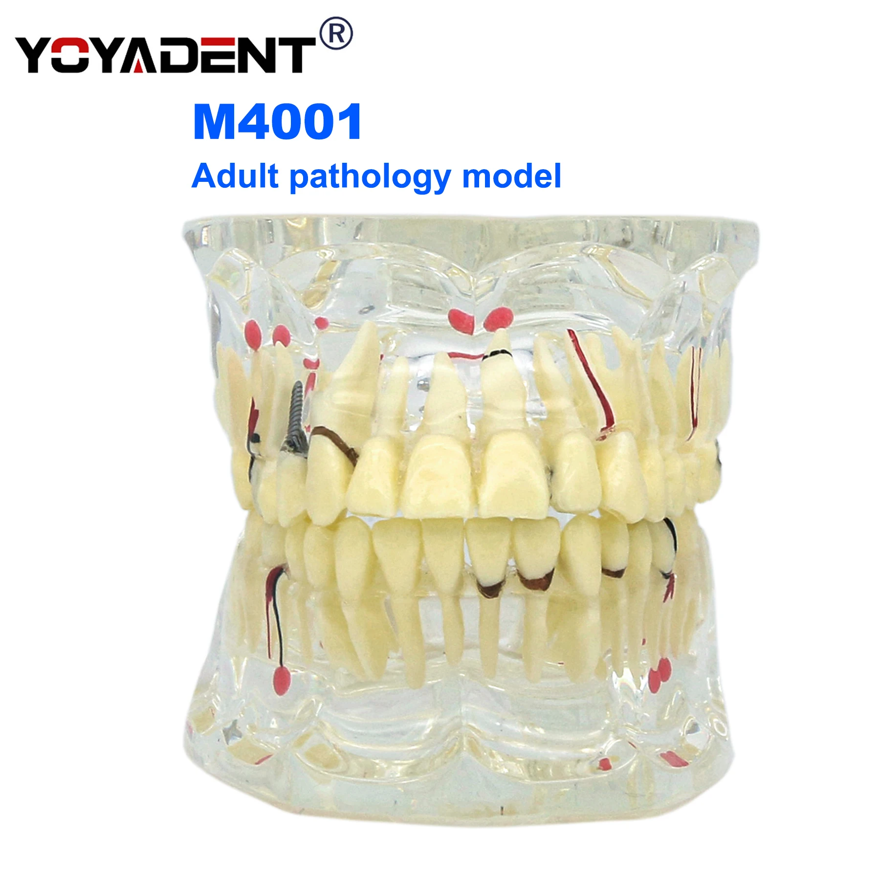 

Dental Teeth Model Adult a variety of dental diseases Model Dentists Teaching Demo Model