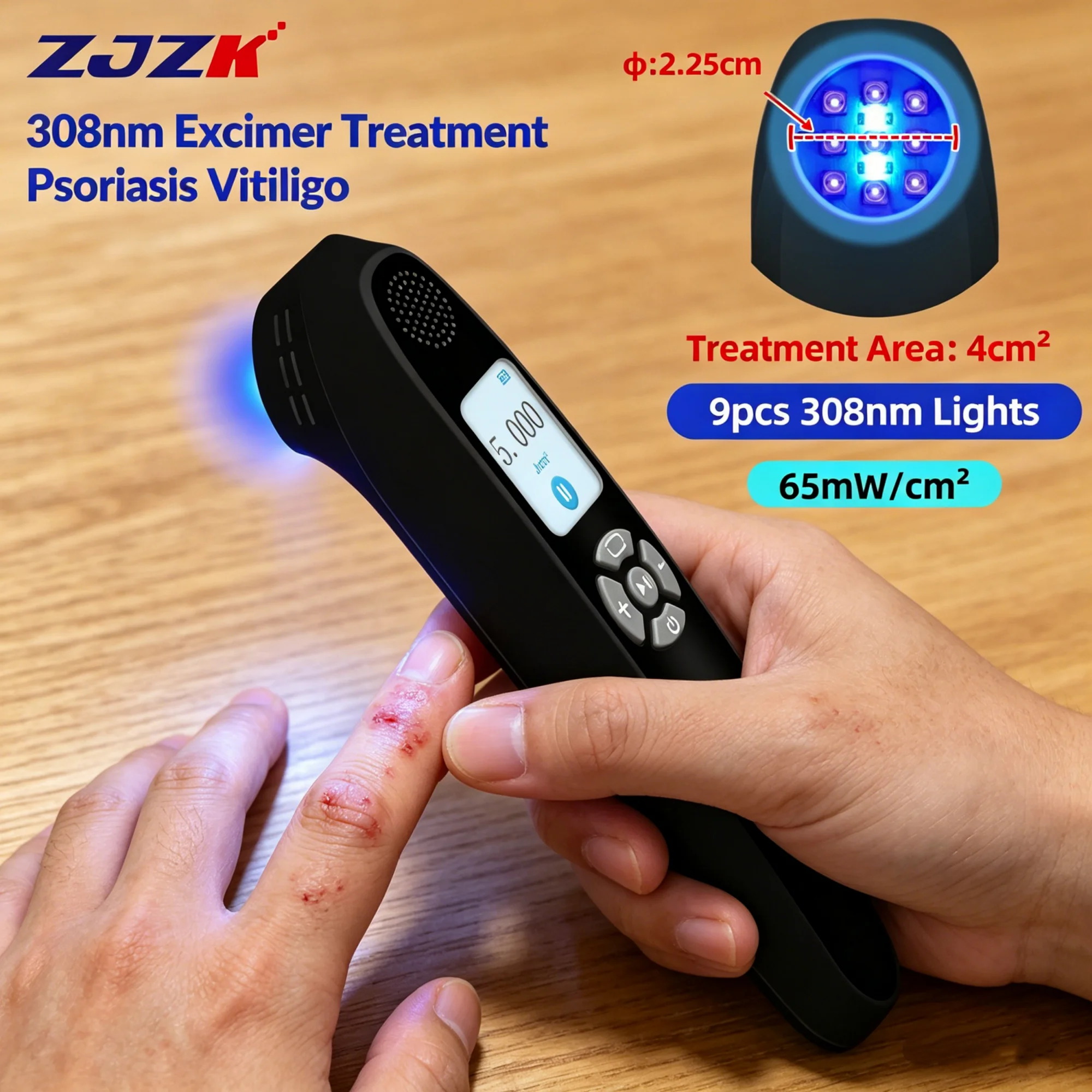 

2026 Non Invasive 308nm Uv Laser Therapy Psoriasis Vitiligo Eczema Marking 308 nm Excimer Uvb Light Traitement for Skin Diseases