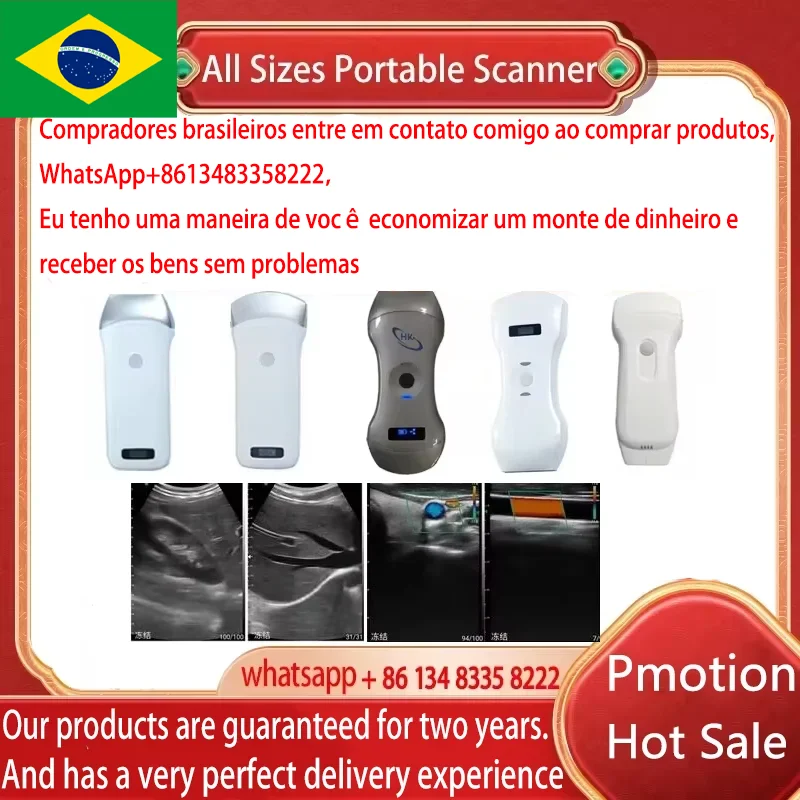 Mala grátis portátil sem fio ultrassom sonda scanner máquina portátil wifi ultrassom scanner máquina sonostar marca fábrica
