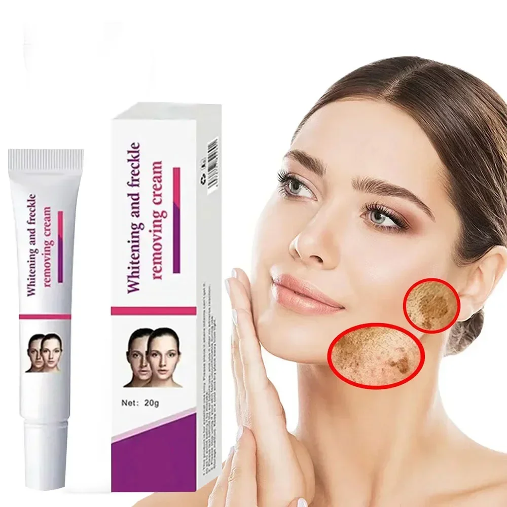 Freckles Removal Cream Remove Facial Spots Skin Dark Spot Remove Melasma Age Spots Sunspots Whitening And Freckle Removing Cream