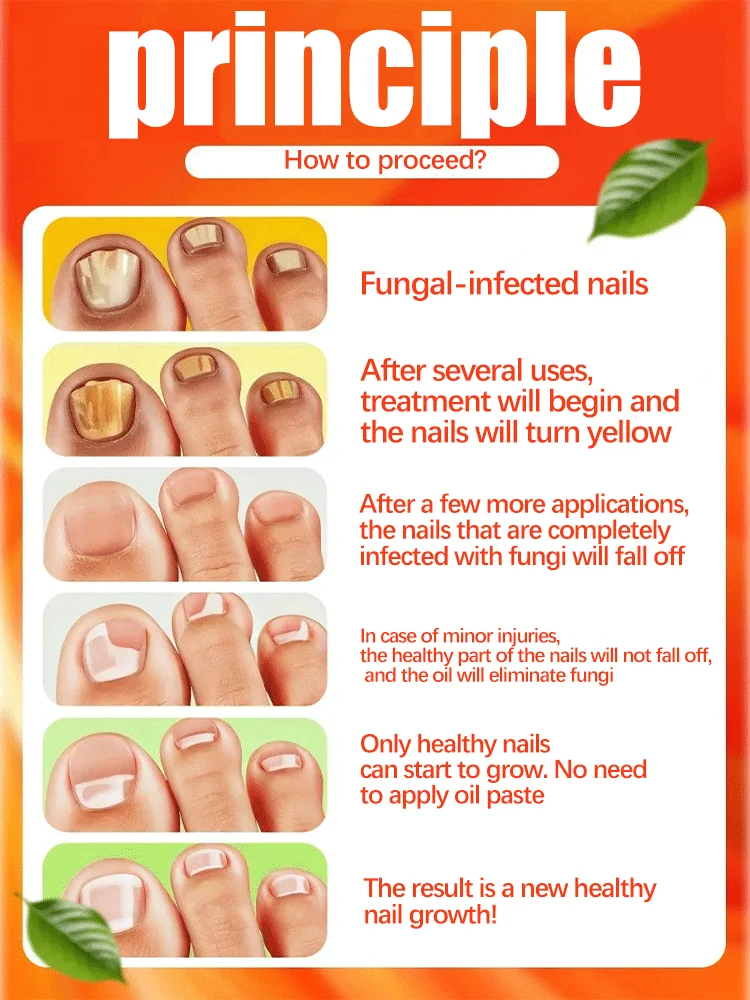 Blue laser care manicure