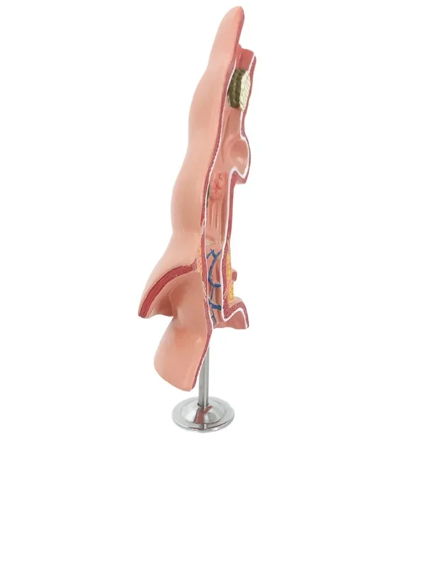 High-quality esophageal pathology school teaching model
