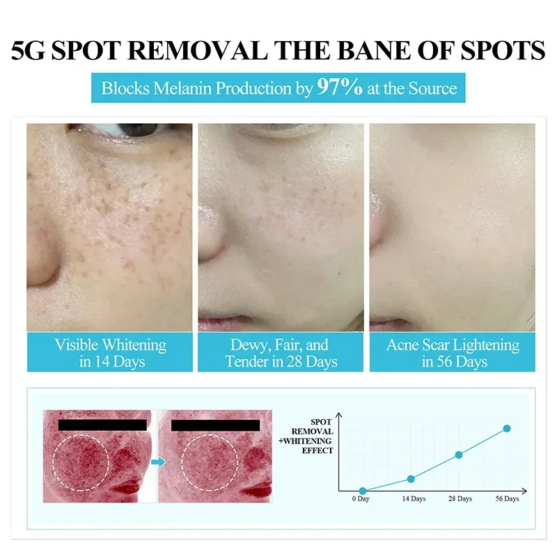 Freckle Removal Cream Face Dark Spot Melasma Remover Lighten Pigmentation Brighten Products Moisturizing Whitening Skin Care