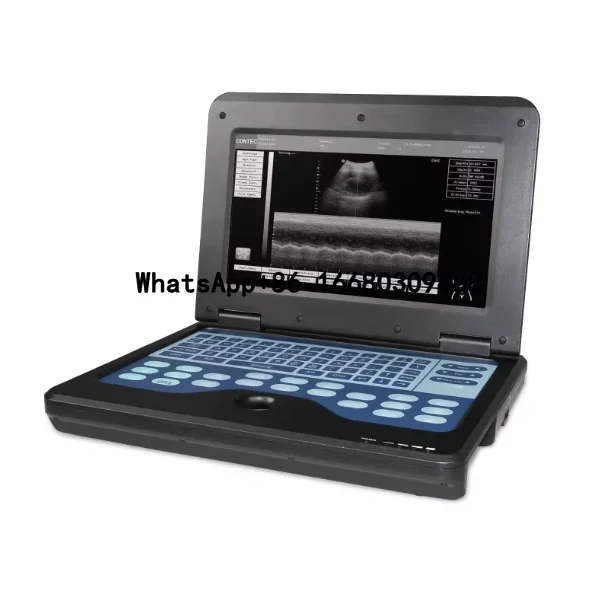 Amain Certifications AM600P2 10.1 inch Digital laptop ultrasound scanner