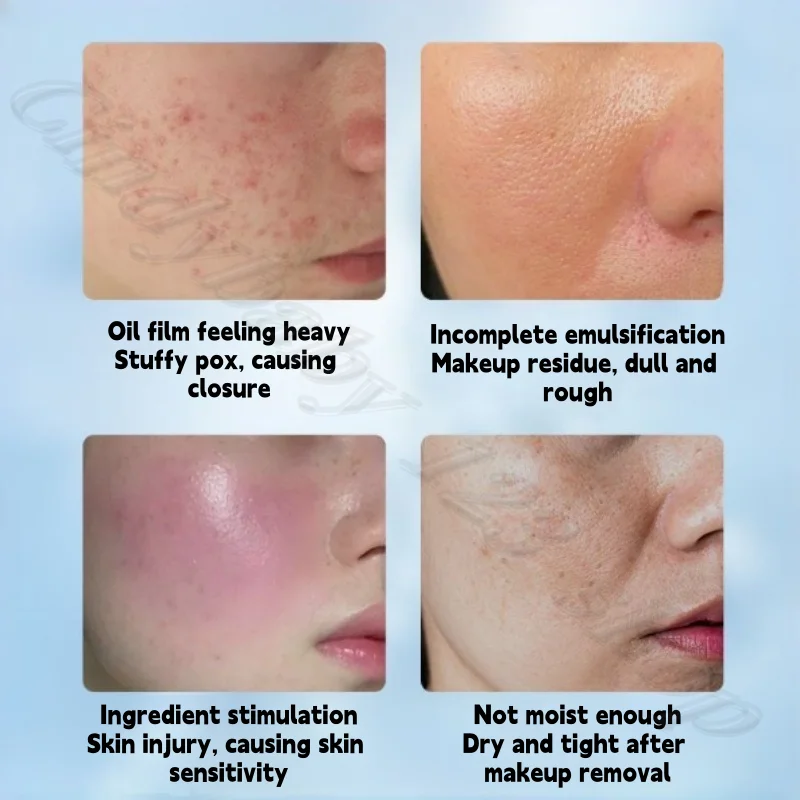 OHBT Cleansing Oil Gentle Cleansing does not irritate sensitive muscles, eyes and lips, full face 3-in-1 blackhead remover 150ml