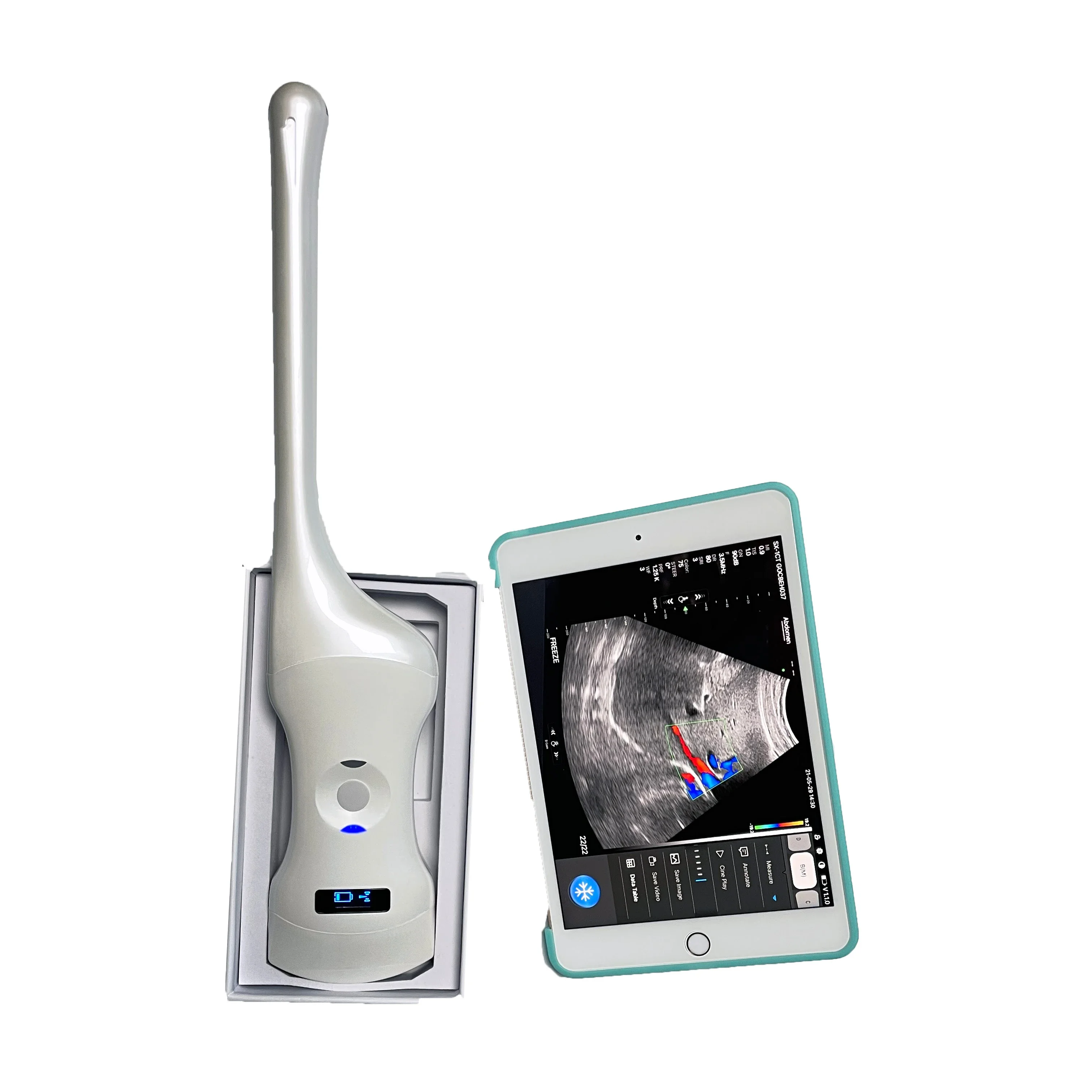 wireless double head transvaginal/convex/phased array ultrasound probe handheld medical  scanner