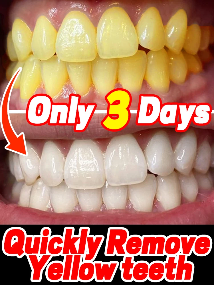 Get white, sparkling teeth fast！