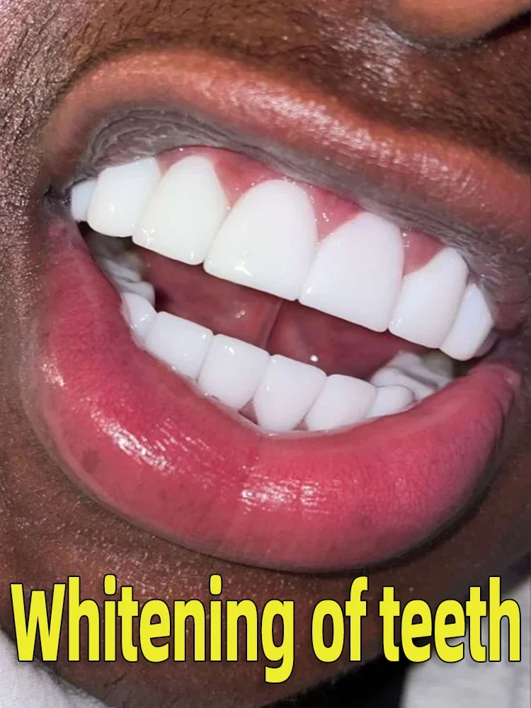 

Resolva todos os problemas dentários~