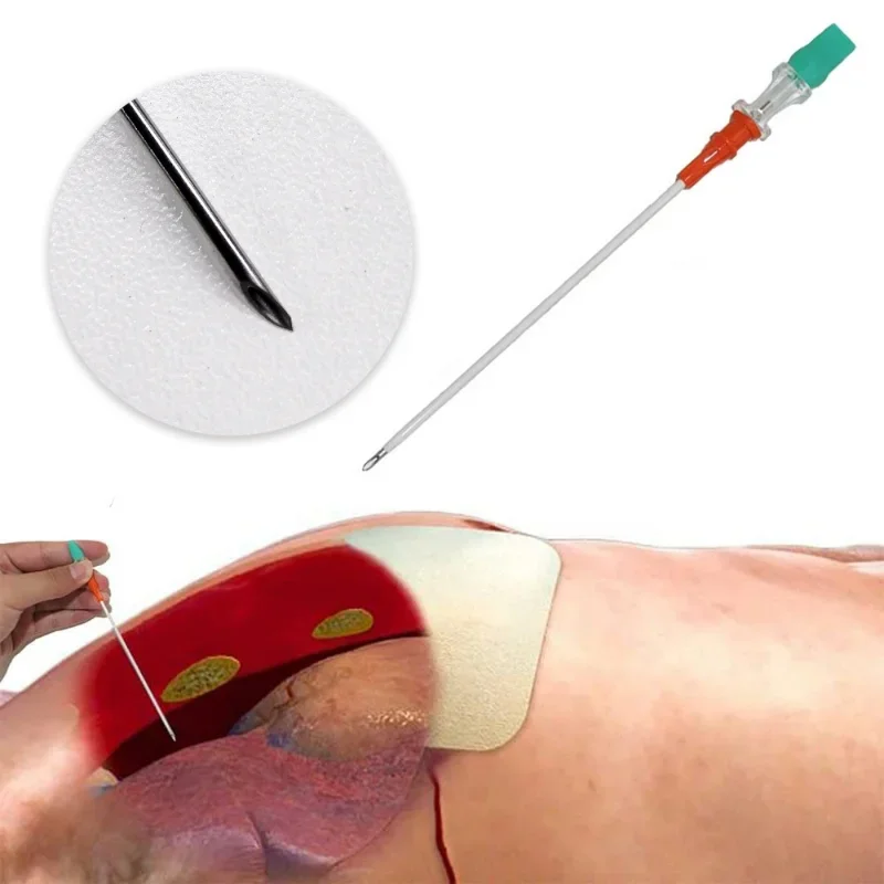 Rescue Tension Pneumothorax Access Kit Sterilized Body Piercing Sewing Puncture Decompression Needles