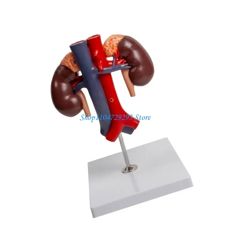 O modelo anatômico do Y2GD inclui aorta abdominal, pâncreas, baço e duodeno