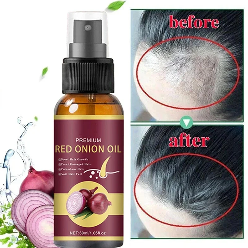 Serum penumbuh rambut, semprot memperbaiki akar penumbuh rambut Anti rambut rontok perawatan kuat untuk pria wanita perawatan rambut