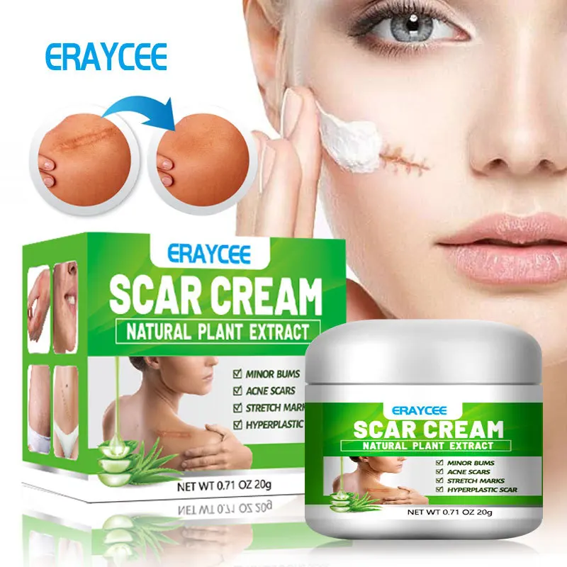 

ERAYCEE Natural Aloe Vera Scar Fading Cream for Acne Marks, Burns, and Surgeries Nourishing Cracked Repair