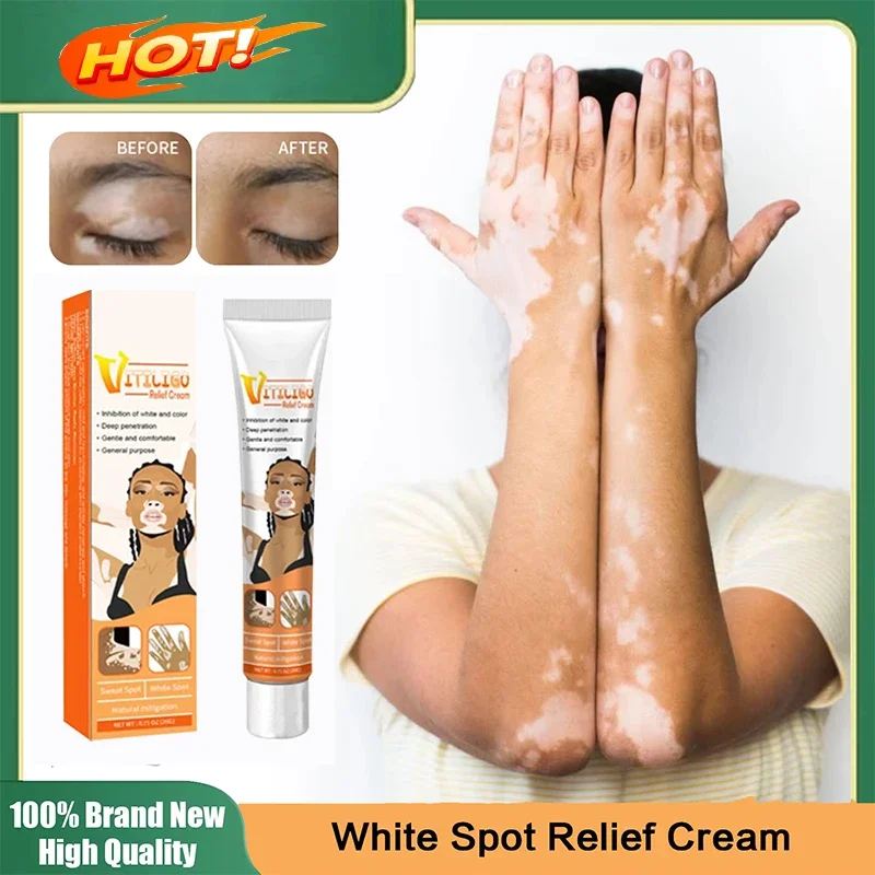 

Body Skin Care Effectively Remove White Spot Removal Skin Vitiligo Eliminate Vitiligo Products