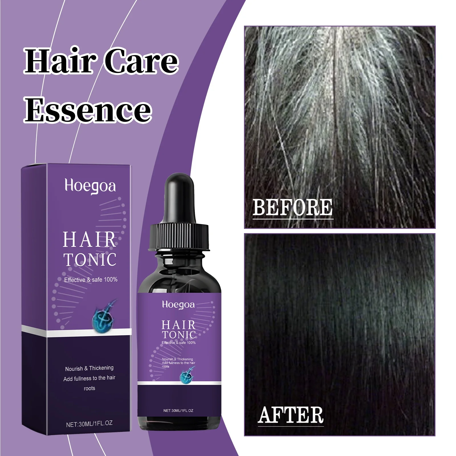 Hair Care Essence Nourish Hair Follicles Reduce Hair Loss Moisturize Hair Root Scalp Hair Care Product Suitable For Men & Women