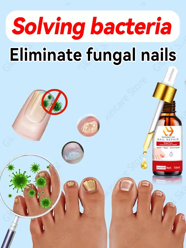 Nail problems? Solved in 7 days!