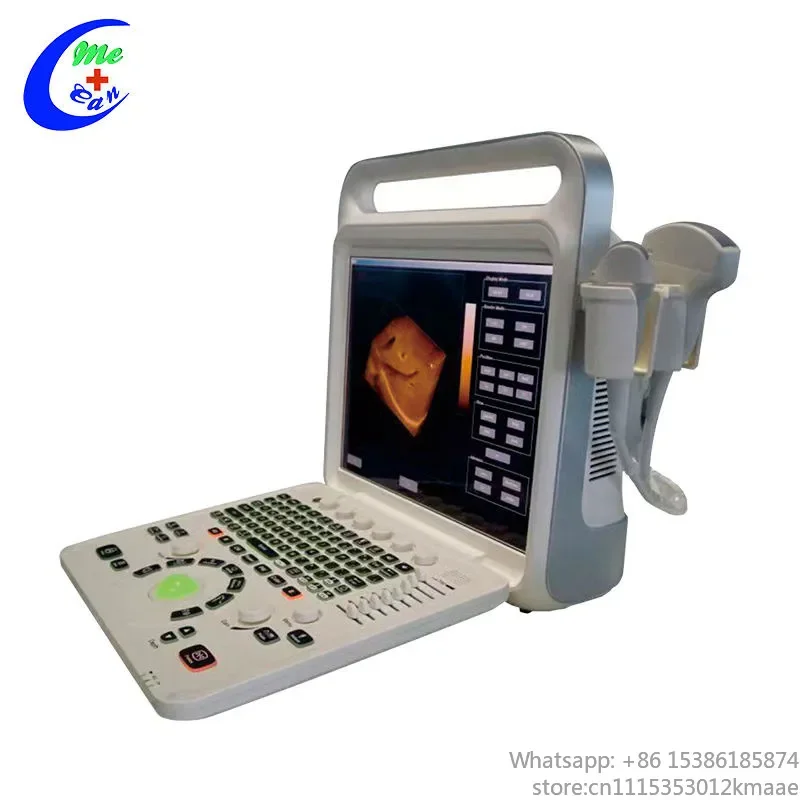 Vequyn 15-Inch Portable Machine with Multiple Probes — Hospital & Clinic Use color doppler Ultrasound