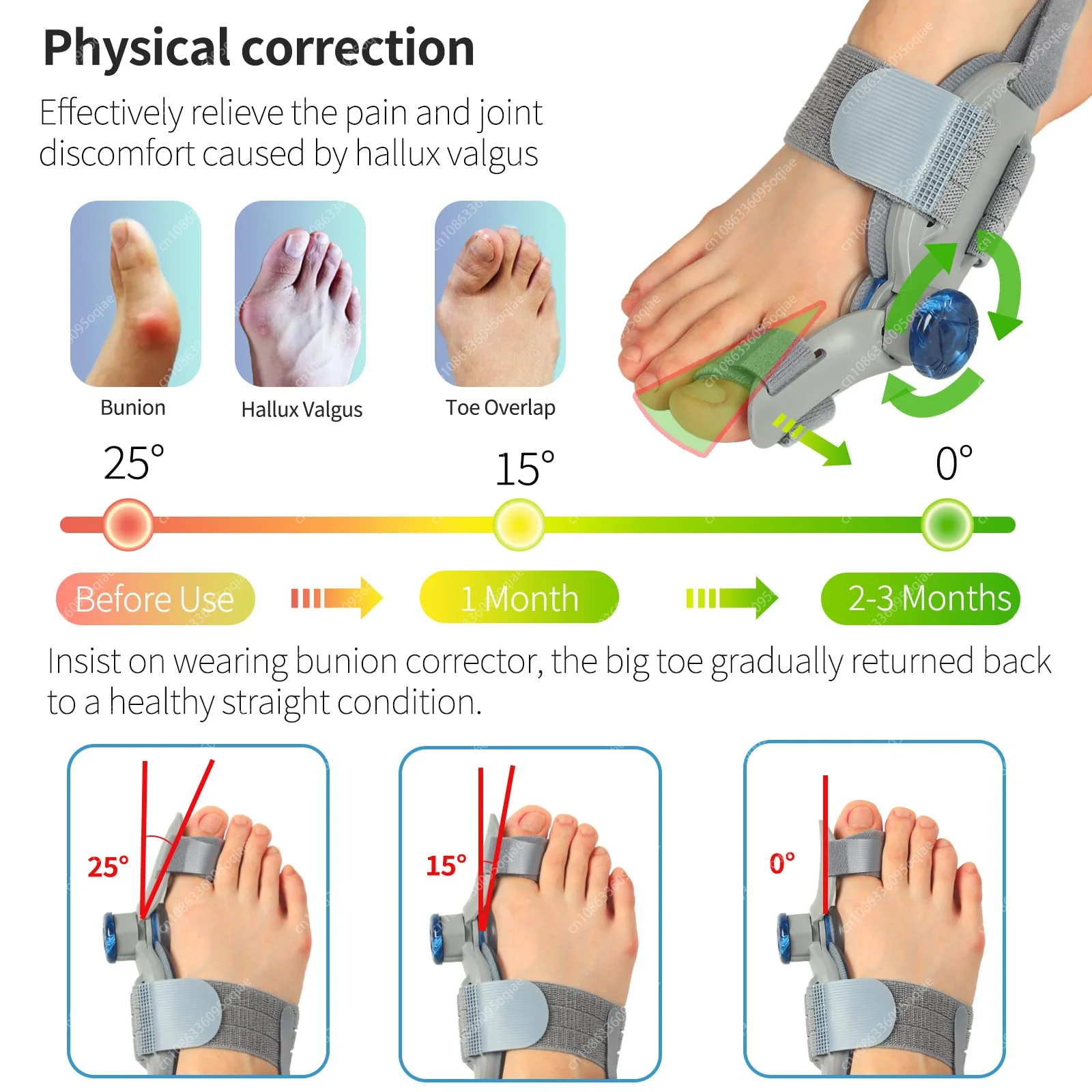 Bunion Splint Big Toe Straightener Corrector Foot Pain Relief Hallux Valgus Correction Orthopedic Supplies Pedicure Foot Care