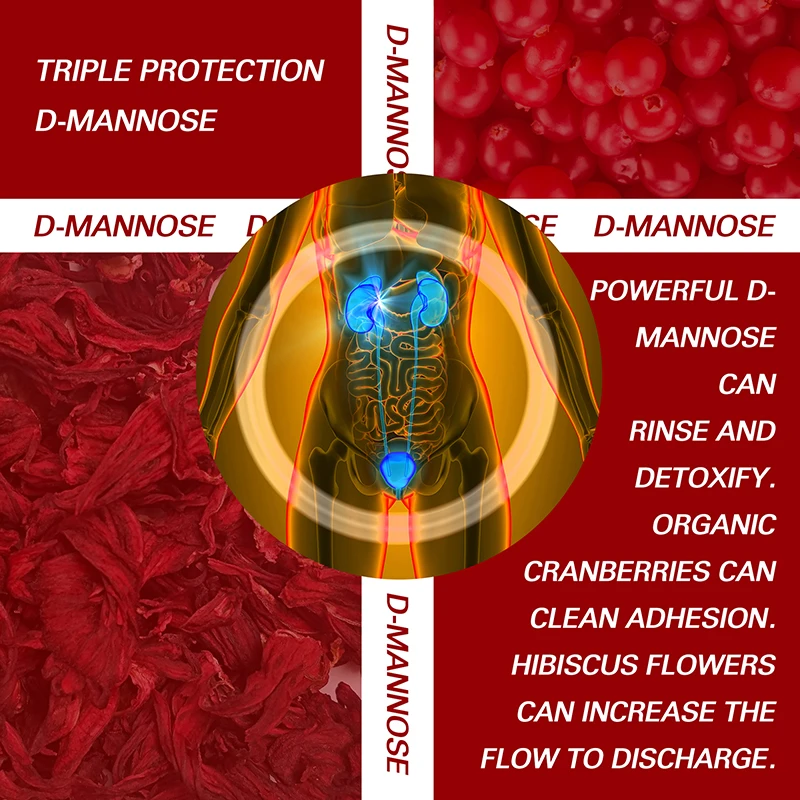 D-Mannose Capsules - with Cranberry - UTI Support & Cleanse, Bladder Health, Extra Strength Natural Urinary Health Support