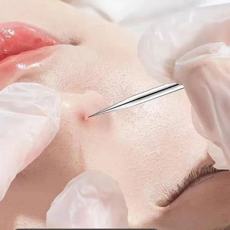 ステンレス鋼の黒ずみ除去ピンセットニキビクリップニキビ針スキンクリーニングツール美容細胞ケア用