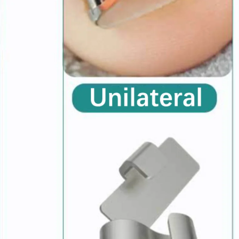 Ingrown Toenail Corrector Tools Pedicure Recover Embed Toe Nail Treatment Professional Ingrown Toenail Correction Foot Care Too