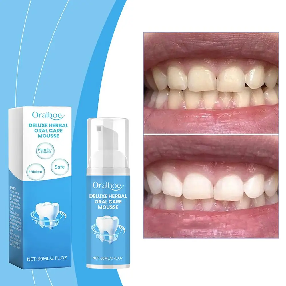 New 1PC High-end Toothpaste Teeth Cleaner Remove Stains Breath Hygiene Toothpaste Powder Oral Care Mousse Fresh Brightening R0J1