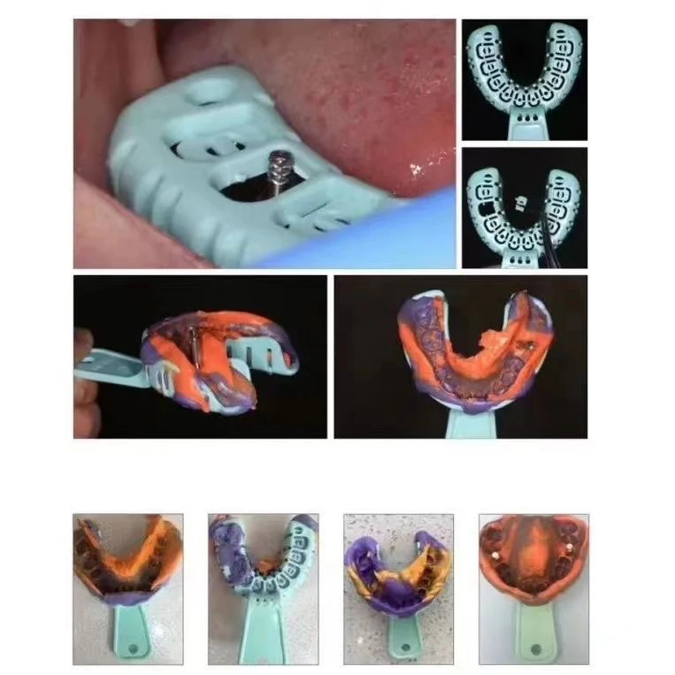 Ensemble d'empreintes dentaires, plateau en plastique S/M/L, plateau pour Implant dentaire, bouche complète, plateau de moule partiel amovible, facile à plier, 6 pièces