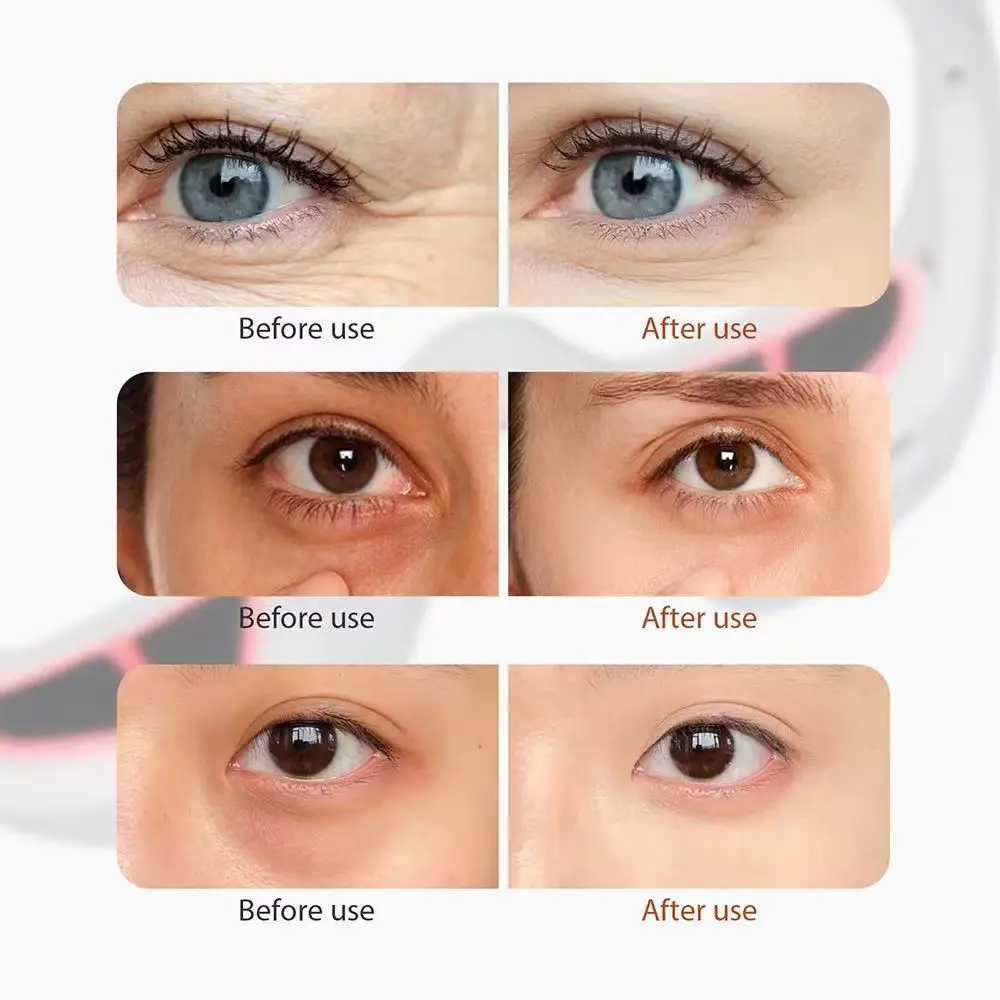 

3D Red Light EMS Eye Massager Eyecare Glasses Dark Circles Puffiness Wrinkles Reduction Eye Fatigue Relaxing Beauty Care Device