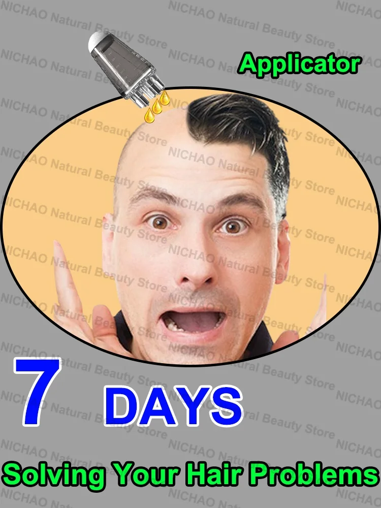 

7 Days Fast Hair Growth Essential Loss Regrowth Treatment Strengthens Hair Nourishes Scalp Light Weight Non Greasy
