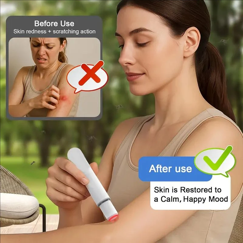 جهاز تخفيف الحكة الكهربائي المحمول القابل لإعادة الشحن - تخفيف سريع لدغات البعوض، أداة صيفية أساسية مضادة للبعوض، البعوض