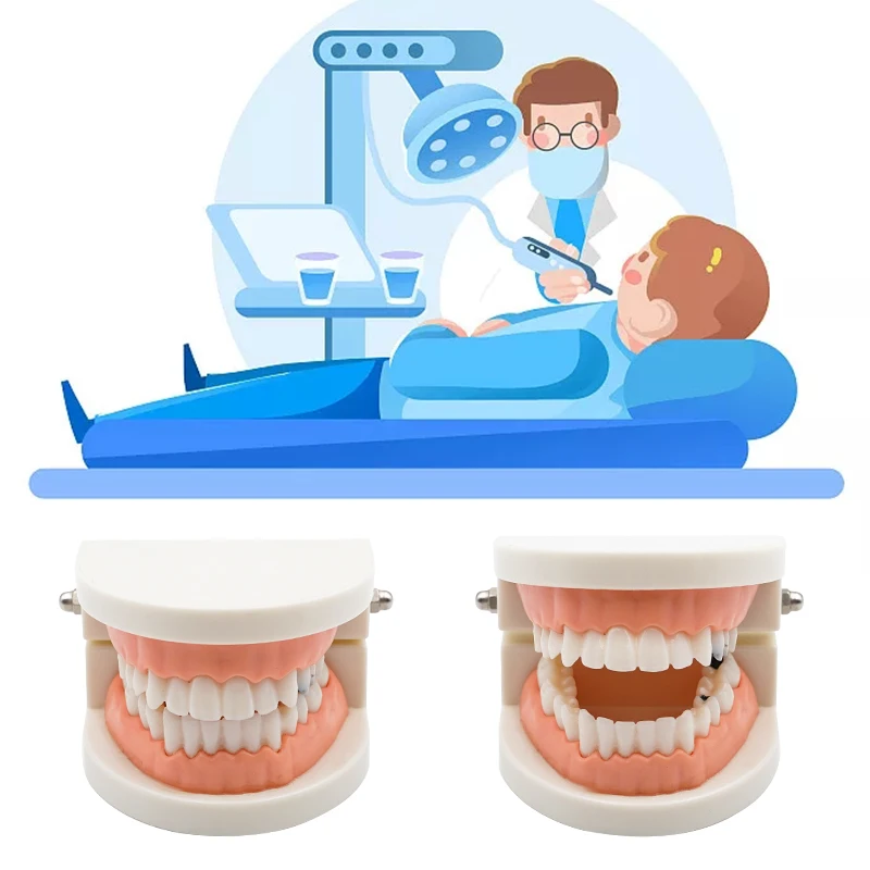 1pc Dental Model Dental Caries Model Teeth Periodontal Disease Model Dentist Material Dental Teaching Models Study