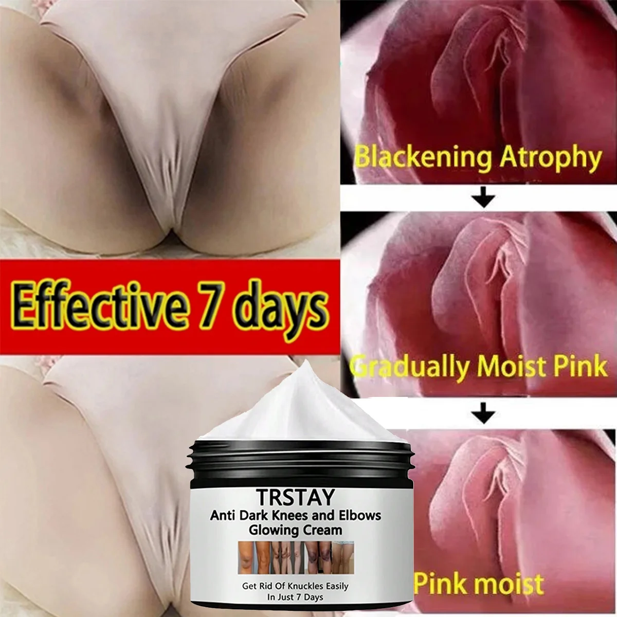 

Отбеливающий крем TRSTAY для ухода за кожей, удаляет местный пигмент, отложения, отбеливает частные зоны и суставы, делает кожу, полупрозрачный