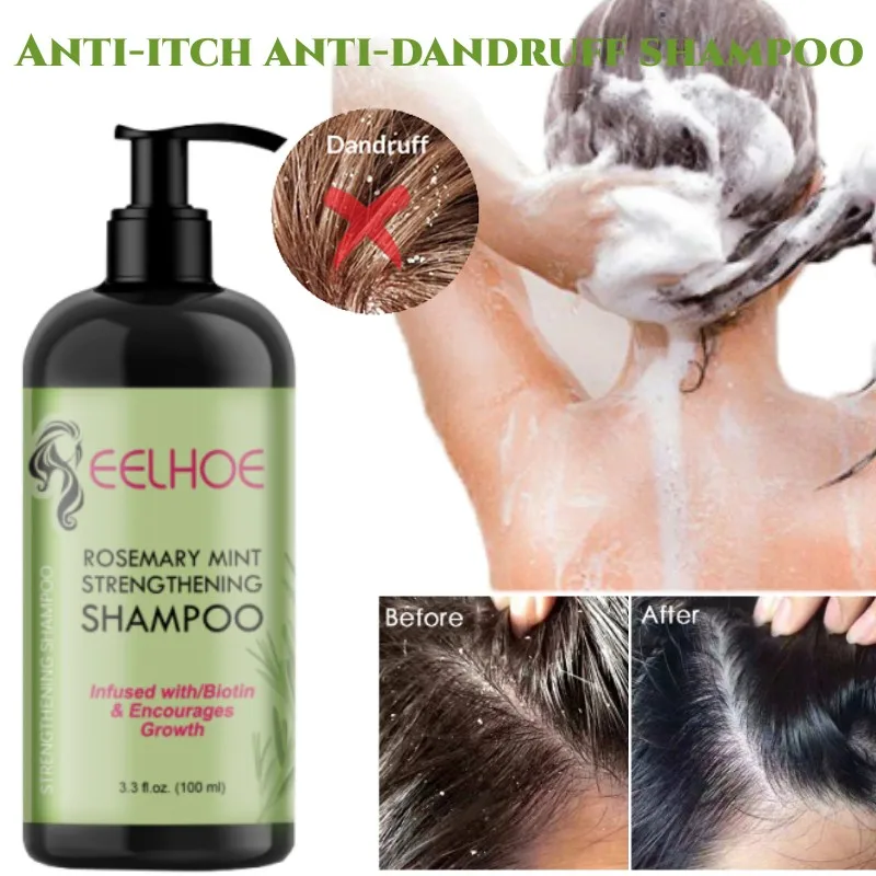 

Organics Rosemary Mint Strengthening Shampoo Infused Deep Cleaning Anti-itch Anti-dandruff Repair Dry Damaged Hair Shampoo